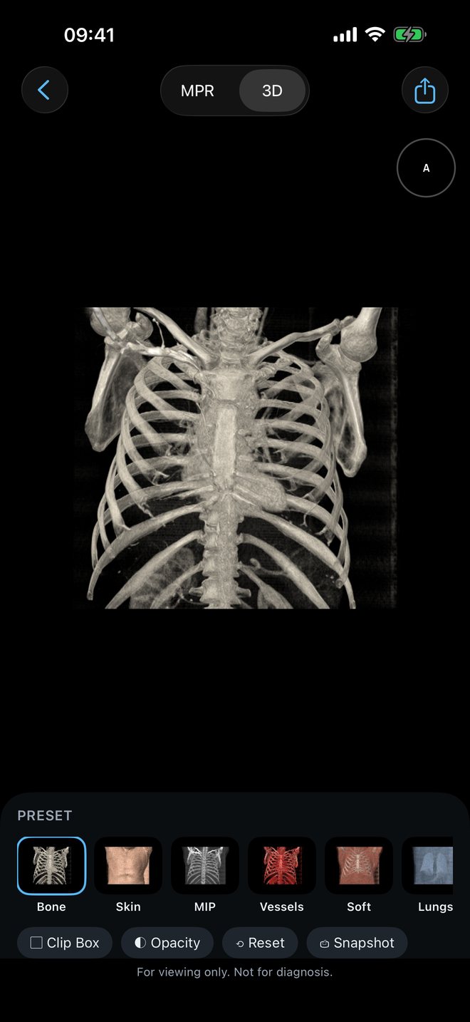 A 3D volume rendering of a CT scan in Raykin