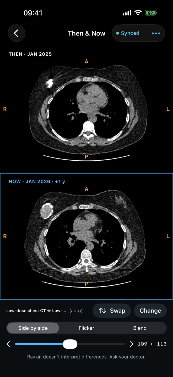 Then & Now in Raykin, comparing scans from two dates side by side